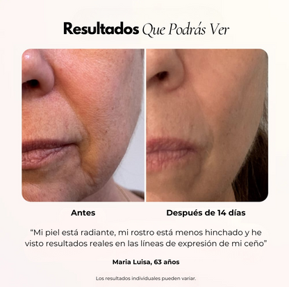 Luminis 4D ™ Terapia Facial LED antiarrugas y manchas