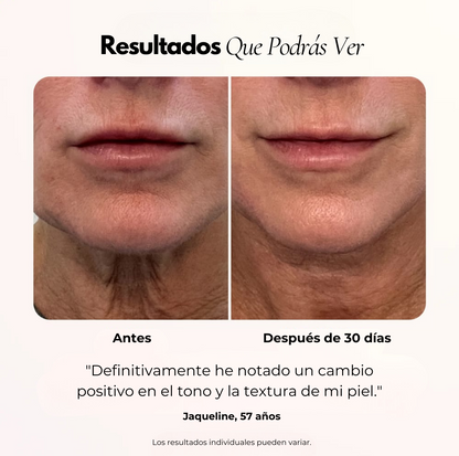 Luminis 4D ™ Terapia Facial LED antiarrugas y manchas
