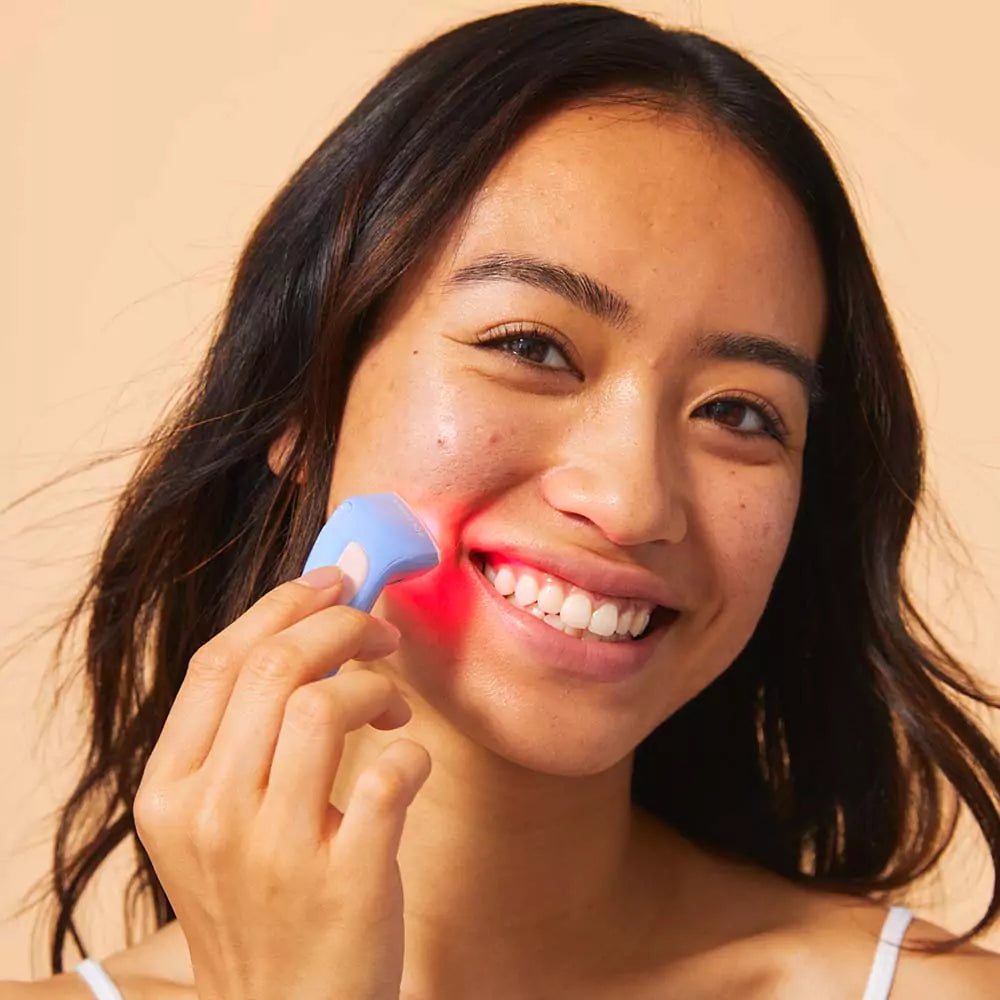 Bye Acné QSKIN dispositivo portátil para tratamiento de espinillas