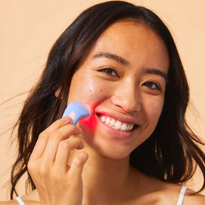 Bye Acné QSKIN dispositivo portátil para tratamiento de espinillas