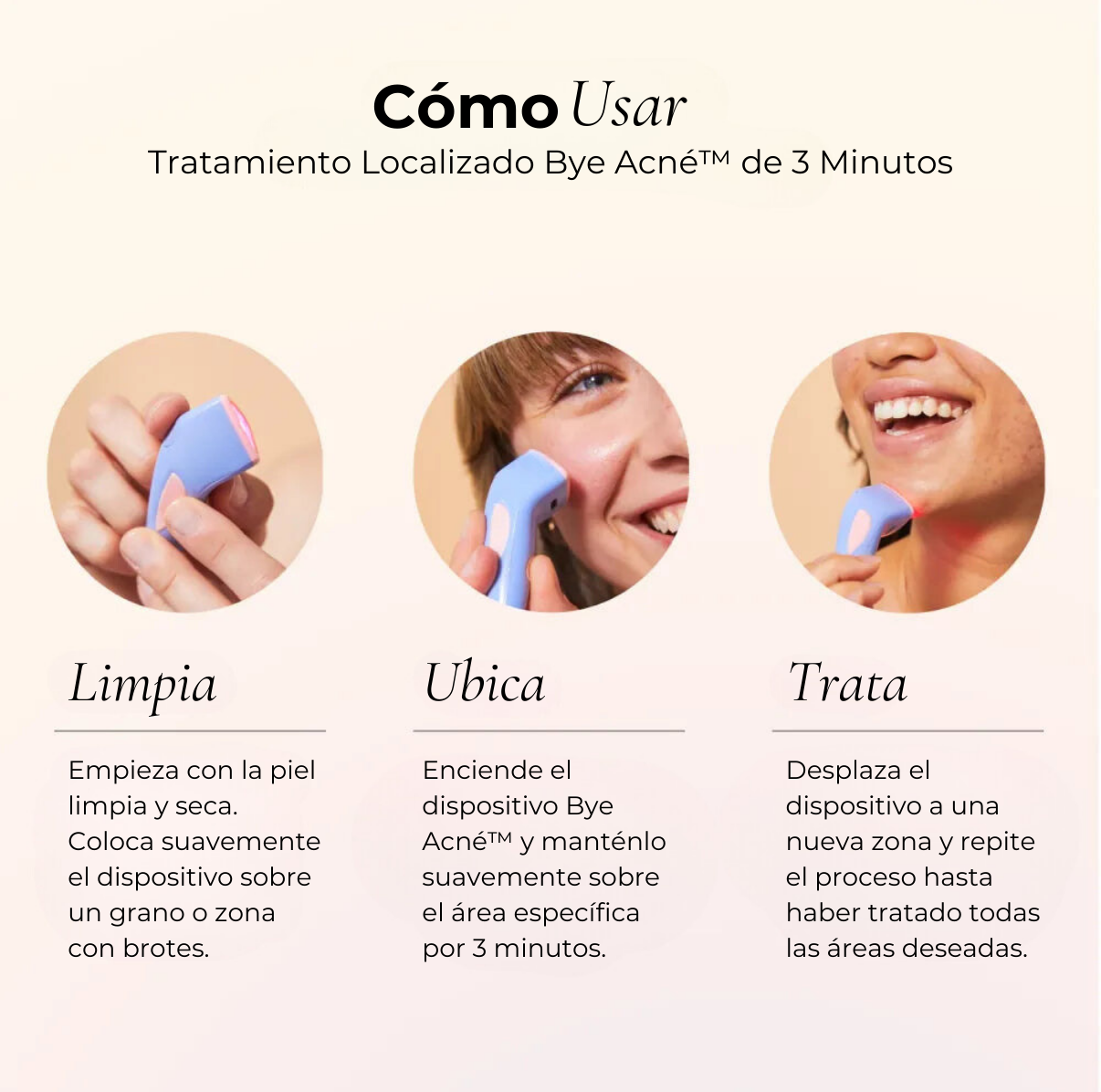 Bye Acné QSKIN dispositivo compacto tratamiento espinillas Chile